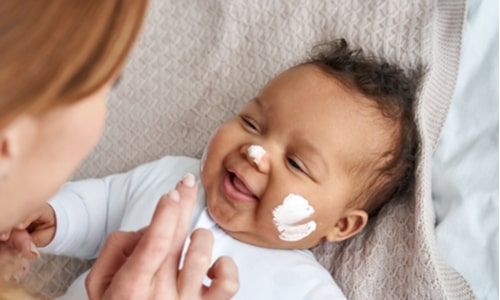 How To Care For Your Baby’s Skin - Advice From A Dermatologist